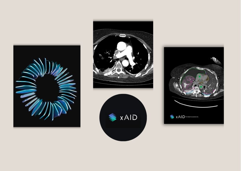 Choosing the Right AI Radiology Vendor for Your Team copy of white and teal image collage retirement card 1789052249948 e1c38167